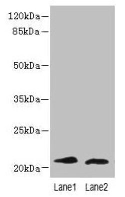 Invitrogen LRRC20 Polyclonal Antibody 100 &mu;g; Unconjugated:Antibodies,