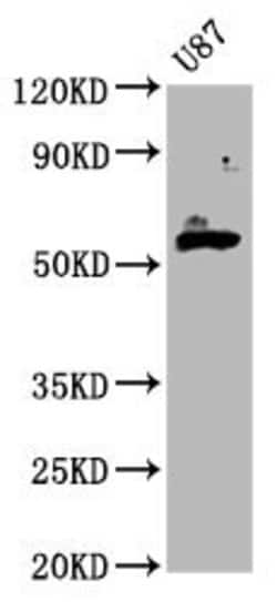 Invitrogen GPT2 Polyclonal Antibody 100 &mu;g | Buy Online | Invitrogen&trade; | Fisher Scientific