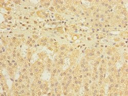 Invitrogen DIS3L Polyclonal Antibody 100 &mu;g; Unconjugated:Antibodies,