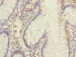 Invitrogen DIS3L Polyclonal Antibody 100 &mu;g; Unconjugated:Antibodies,