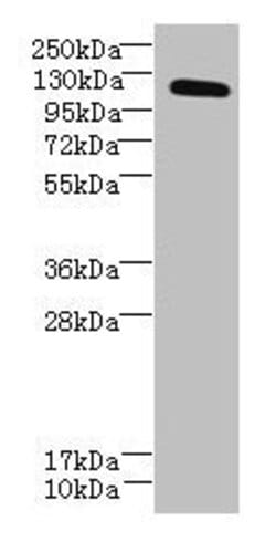 Invitrogen DIS3L Polyclonal Antibody 100 &mu;g; Unconjugated:Antibodies,