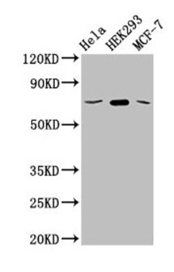 Invitrogen SLC20A1 Polyclonal Antibody 100 &mu;g; Unconjugated:Antibodies,