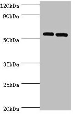 Invitrogen ATGL Polyclonal Antibody 100 &mu;L; Unconjugated:Antibodies,