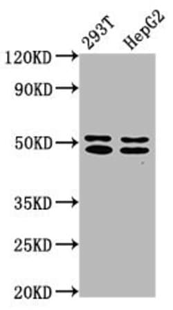 TRNT1 Polyclonal Antibody:Antibodies, Polyclonal