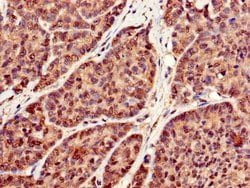 Invitrogen RBFA Polyclonal Antibody 100 &mu;g; Unconjugated:Antibodies,
