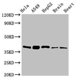 Invitrogen RBFA Polyclonal Antibody 100 &mu;g; Unconjugated:Antibodies,