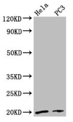 Invitrogen NDUFAF2 Polyclonal Antibody 100 &mu;g; Unconjugated:Antibodies,