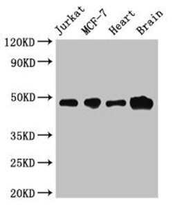 Invitrogen ZNF645 Polyclonal Antibody 100 &mu;g; Unconjugated:Antibodies,