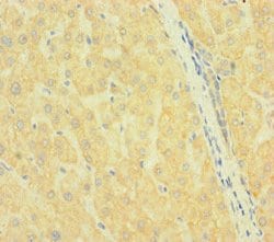 Invitrogen SLC38A9 Polyclonal Antibody 100 &mu;g; Unconjugated:Antibodies,