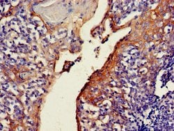 Invitrogen C4orf14 Polyclonal Antibody 100 &mu;g | Buy Online | Invitrogen&trade; | Fisher Scientific