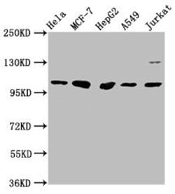 Invitrogen GANC Polyclonal Antibody 100 &mu;L; Unconjugated:Antibodies,