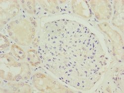 Invitrogen HOOK2 Polyclonal Antibody 100 &mu;L | Buy Online | Invitrogen&trade; | Fisher Scientific