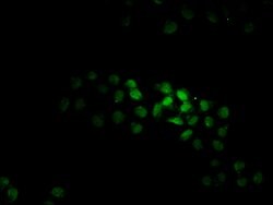 Invitrogen KTI12 Polyclonal Antibody 100 &mu;g; Unconjugated:Antibodies,