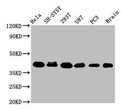 Invitrogen KTI12 Polyclonal Antibody 100 &mu;g; Unconjugated:Antibodies,