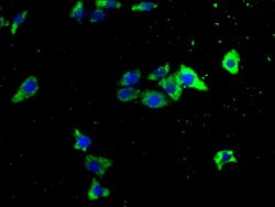 ITCH Polyclonal Antibody:Antibodies, Polyclonal