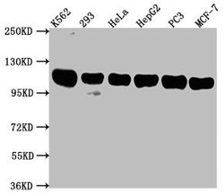 ITCH Polyclonal Antibody:Antibodies, Polyclonal