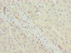 Invitrogen LLCFC1 Polyclonal Antibody 100 &mu;g; Unconjugated:Antibodies,