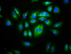 Invitrogen CD99L2 Polyclonal Antibody 100 &mu;g; Unconjugated:Antibodies,