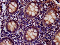 Invitrogen CD99L2 Polyclonal Antibody 100 &mu;g; Unconjugated:Antibodies,