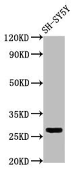 Invitrogen CD99L2 Polyclonal Antibody 100 &mu;g; Unconjugated:Antibodies,