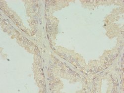 Invitrogen RQCD1 Polyclonal Antibody 100 &mu;g | Buy Online | Invitrogen&trade; | Fisher Scientific
