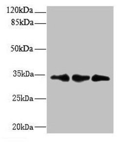 Invitrogen RQCD1 Polyclonal Antibody 100 &mu;g | Buy Online | Invitrogen&trade; | Fisher Scientific