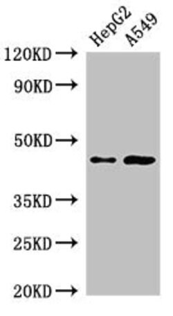 Invitrogen PIGK Polyclonal Antibody 100 &mu;g | Buy Online | Invitrogen&trade; | Fisher Scientific