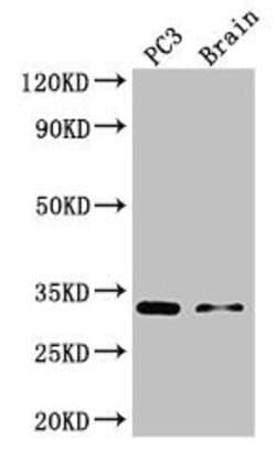 Invitrogen HOXB13 Polyclonal Antibody 100 &mu;g; Unconjugated:Antibodies,