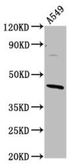 Invitrogen ELMOD3 Polyclonal Antibody 100 &mu;g; Unconjugated:Antibodies,