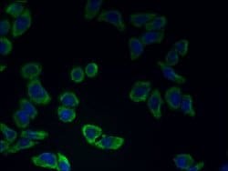 CATSPER2 Polyclonal Antibody:Antibodies, Polyclonal