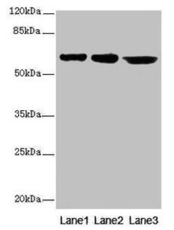 CATSPER2 Polyclonal Antibody:Antibodies, Polyclonal