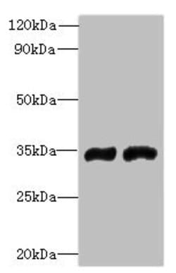 Invitrogen FYTTD1 Polyclonal Antibody 100 &mu;g; Unconjugated:Antibodies,