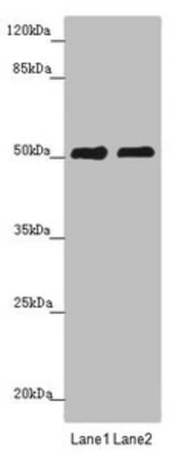 Invitrogen CRBN Polyclonal Antibody 100 &mu;L; Unconjugated:Antibodies,