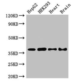 Invitrogen PNKD Polyclonal Antibody 100 &mu;g; Unconjugated:Antibodies,