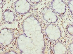Invitrogen GCNT2 Polyclonal Antibody 100 &mu;L | Buy Online | Invitrogen&trade; | Fisher Scientific