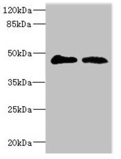 Invitrogen GCNT2 Polyclonal Antibody 100 &mu;L | Buy Online | Invitrogen&trade; | Fisher Scientific