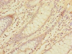 Invitrogen LMO3 Polyclonal Antibody 100 &mu;g; Unconjugated:Antibodies,