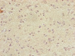Invitrogen DYNC2LI1 Polyclonal Antibody 100 &mu;L; Unconjugated:Antibodies,