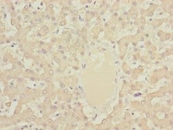 Invitrogen DYNC2LI1 Polyclonal Antibody 100 &mu;L; Unconjugated:Antibodies,