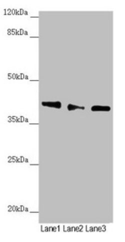 Invitrogen DYNC2LI1 Polyclonal Antibody 100 &mu;L; Unconjugated:Antibodies,