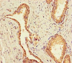 Invitrogen UBE2Q2 Polyclonal Antibody 100 &mu;g; Unconjugated:Antibodies,