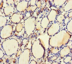 Invitrogen UBE2Q2 Polyclonal Antibody 100 &mu;g; Unconjugated:Antibodies,