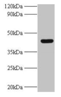 Invitrogen UBE2Q2 Polyclonal Antibody 100 &mu;g; Unconjugated:Antibodies,