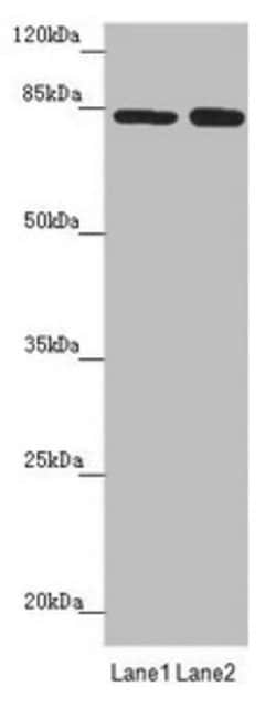 Invitrogen NELL1 Polyclonal Antibody 100 &mu;L; Unconjugated:Antibodies,