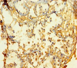 Invitrogen ATOH1 Polyclonal Antibody 100 &mu;g; Unconjugated:Antibodies,