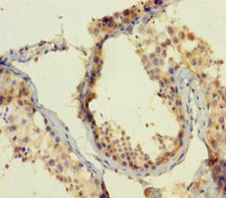 Invitrogen ATOH1 Polyclonal Antibody 100 &mu;g; Unconjugated:Antibodies,