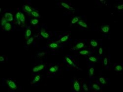 Invitrogen SMARCD1 Polyclonal Antibody 100 &mu;g; Unconjugated:Antibodies,