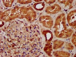 Invitrogen SUCLG2 Polyclonal Antibody 100 &mu;g; Unconjugated:Antibodies,