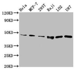 Invitrogen SUCLG2 Polyclonal Antibody 100 &mu;g; Unconjugated:Antibodies,