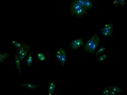 Lass5 Polyclonal Antibody:Antibodies, Polyclonal